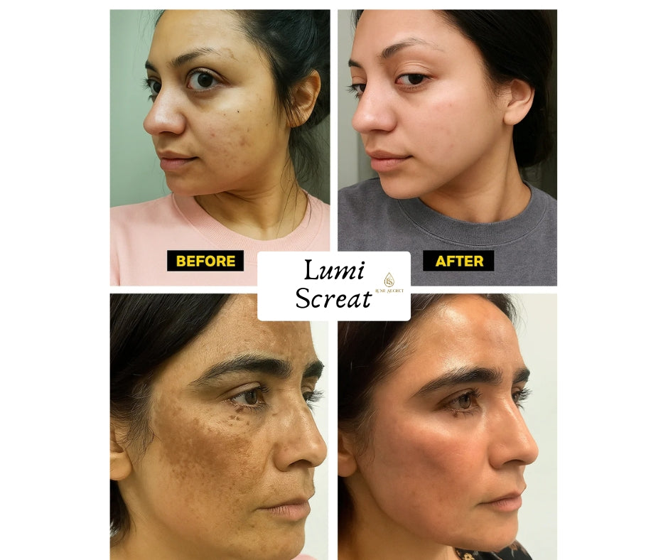 Lumi Secret Underarm & Private parts Brightening Cream